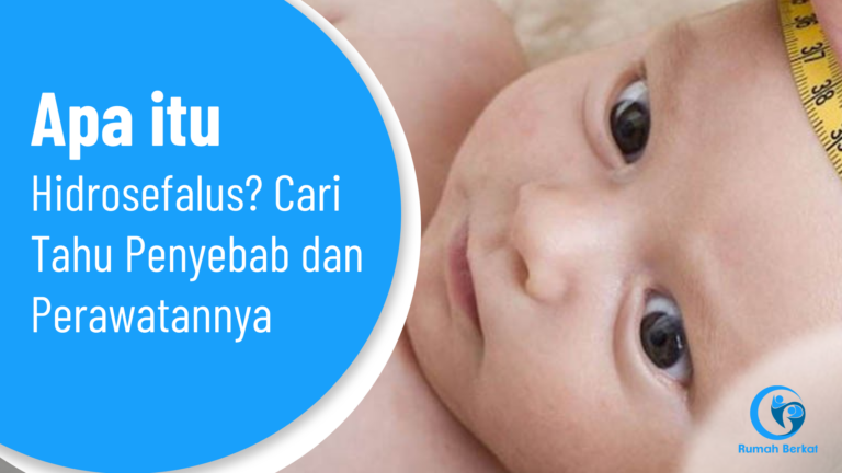 Apa itu Hidrosefalus? Cari Tahu Penyebab dan Perawatannya