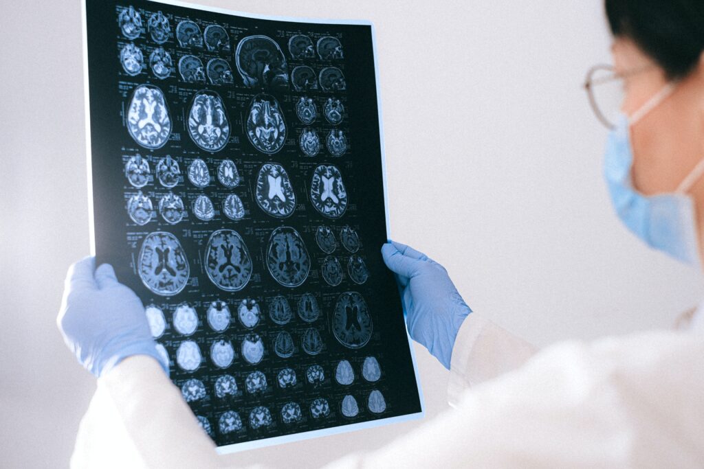 Dokter perempuan memegang hasil CT Scan tumor otak